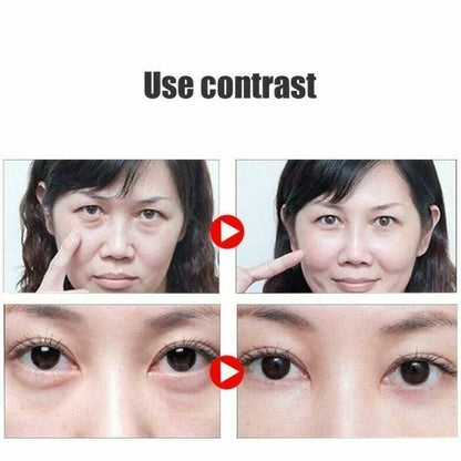 Remove Dark Circles Wrinkles Eye Bags Fat Granules Serum Oil