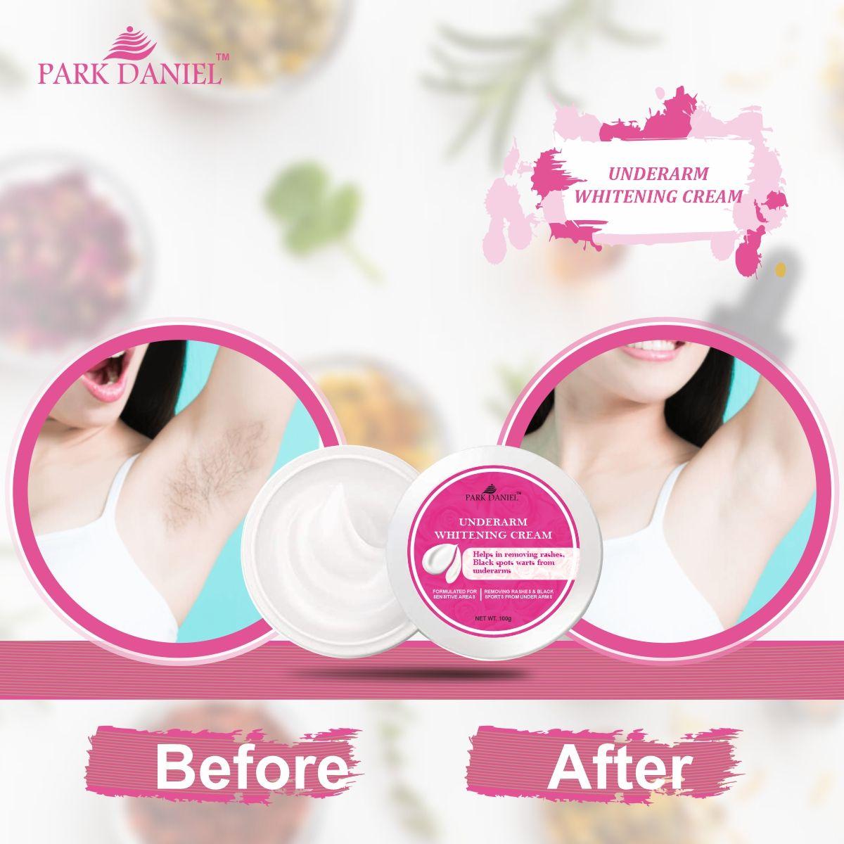 Park Daniel Underarms Darkness Lightening Cream Enriched with Kojic Acid, Nicinamide For Skin Pack of 4 of (100 grams)